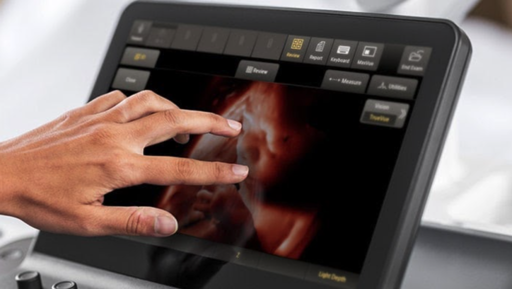 Diagnostic fiable de la santé du fœtus Philips Ultrasound